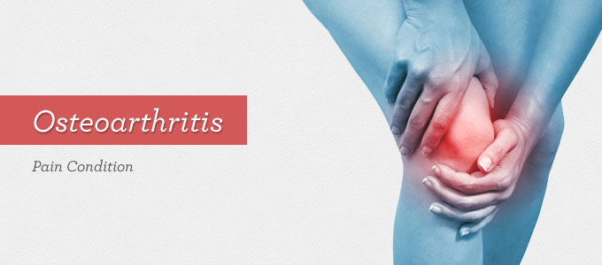 Osteoarthritis: the most common form of Arthritis - Women With Fibromyalgia