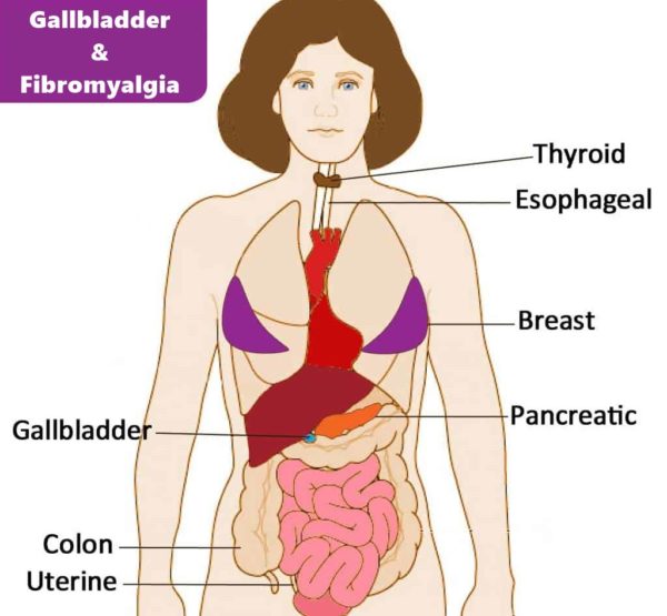 initial symptoms of fibromyalgia